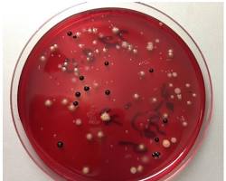 Anaerobic Bacterial Culture