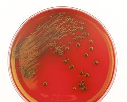 Aerobic Bacterial Culture & Sensitivity (Routine)