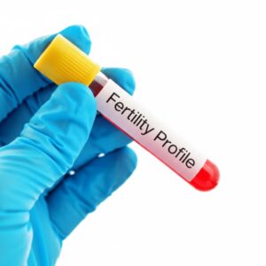 Dk Fertility Profile-Men