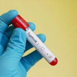 Typhidot IgG (Salmonella IgG) Thyphoid test