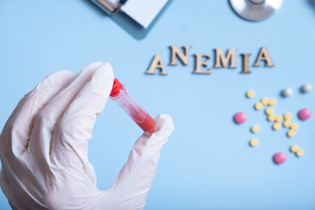 Anemia Profile Test