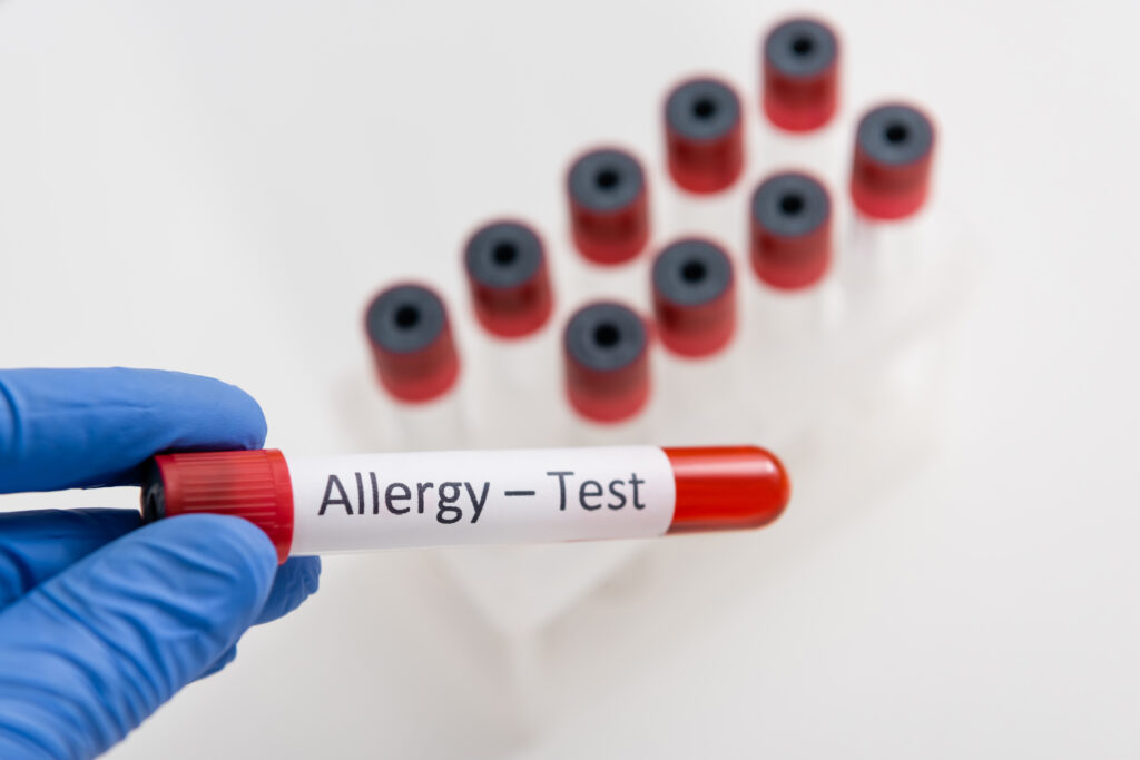 Allergy Drug Panel Test