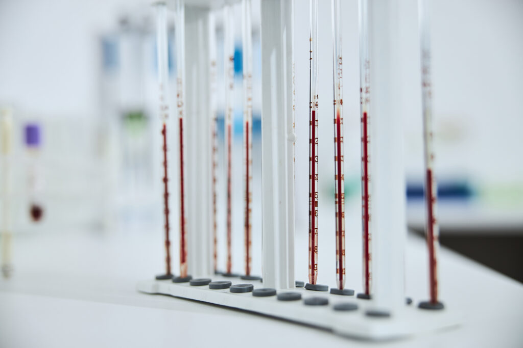 Best Diagnostic Lab in Hyderabad