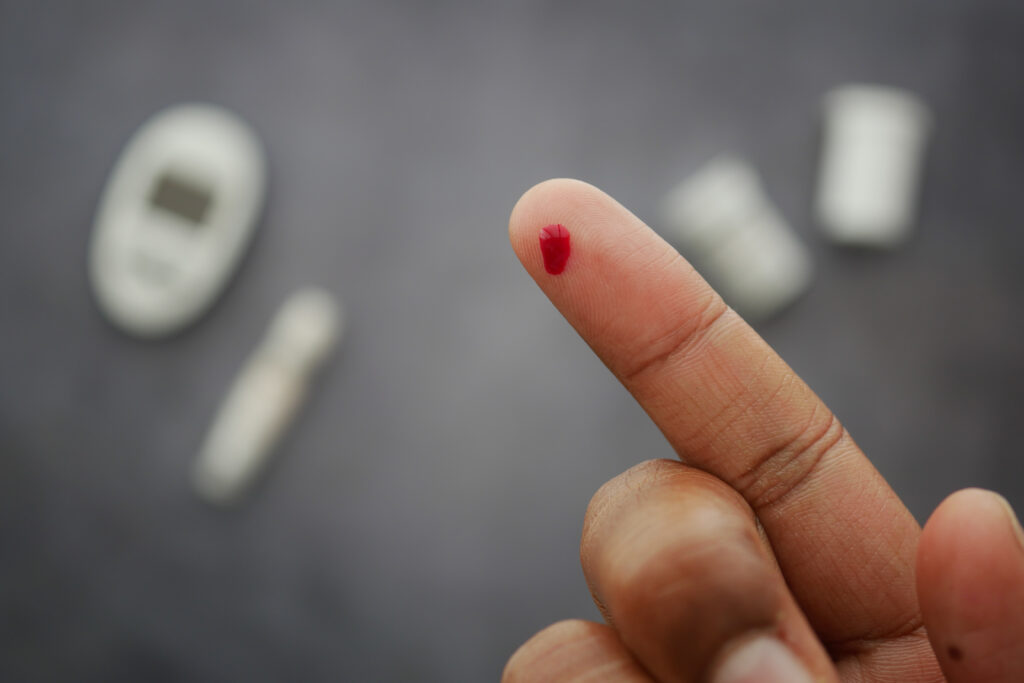 Random Blood Sugar Test in Hyderabad